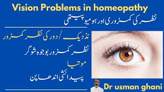 Vision Problems in homeopathy نطر کے مسائل اور ہومیوپیتھی Dr usman ghani [upl. by Madanhoj]