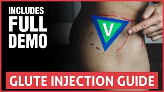 How To Do A Glute Injection  Full Guide And Demo [upl. by Reave]