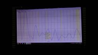 160m Endfed Antenna DIY [upl. by Rep714]