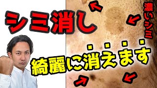 濃いシミも消す一番の方法はこれ！昔の美肌が蘇る。【化粧品原料のプロが解説】 [upl. by Atiuqahs]