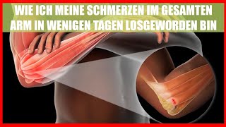 TENNISELLENBOGEN IMPINGEMENTSYNDROM und BIZEPSSEHNENENTZÜNDUNG  Wie ich es losgeworden bin [upl. by Kenrick]