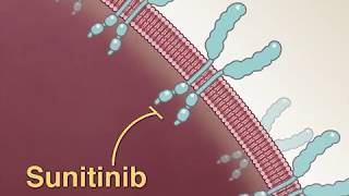 Treating Advanced RenalCell Carcinoma [upl. by Beckett]