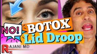 BOTOX EYELID DROOP Botox Before and After [upl. by Attehcram641]