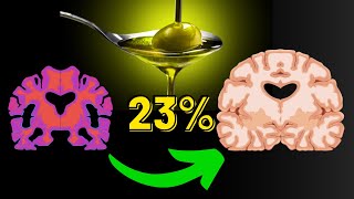 Demenz und Alzheimerrisiko um 23 senken mit Ernährung [upl. by Pineda]