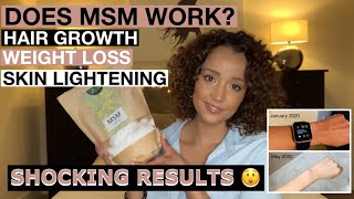 MSM for Hair Growth Weight Loss amp Skin Lightening  6 Month Update  SHOCKING RESULTS [upl. by Ame175]