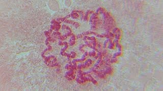 POLYTENE CHROMOSOME OF Drosophila sp FRUIT FLY [upl. by Novoj]