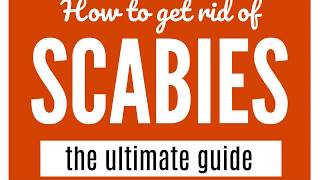 How To Get Rid Of Scabies A Guide That WORKS [upl. by Leasim]