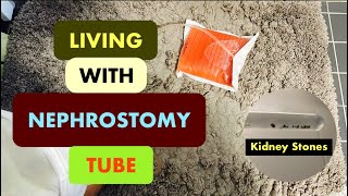 Nephrostomy Tube  Nefrostomi  Nephrostomy Journey  Nephrostomy Tube Care  Nephrostomy Tips [upl. by Nutsud]