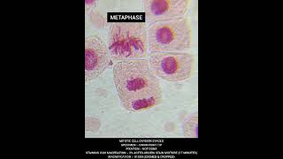 Cell division phases ProphaseMetaphaseAnaphaseTelophase at 1000X zoom experiment science [upl. by Dallis]