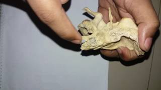 Temporal bone Part2Bangla tutorial [upl. by Ralph12]