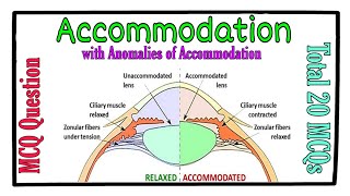 MCQ  Accommodation and its Anomalies [upl. by Htenek837]