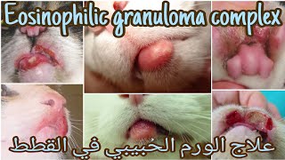 علاج الورم الحبيبي في القططورم الفم في القطط Treatment of eosinophilic granuloma complex in cats [upl. by Aleakam807]