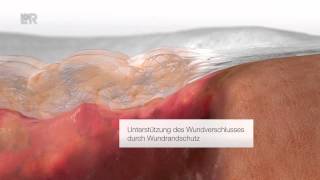 Suprasorb® Liquacel Deutsch [upl. by Boiney]