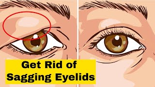 Get Rid of Drooping amp Sagging EYELIDS with These Natural Tips and look Gorgeous every time [upl. by Cordelie]