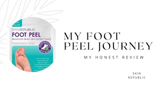 My Honest Skin Republic foot peel review My foot Peel journey 🤮🤢 What a shocker 😳🫣 skincare [upl. by Willa]