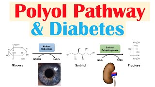 Polyol Pathway amp Diabetes  The Role of Polyol Pathway in Diabetes Pathogenesis [upl. by Ecila]