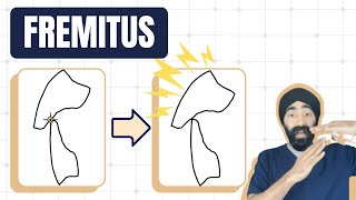 Fremitus and Occlusal Overload  Dental Occlusion Geekiness  PDP160 [upl. by Noellyn]