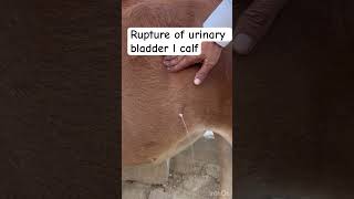 Rupture of urinary bladder l dr Umar khan [upl. by Mharg562]