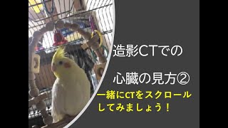 造影CTの心臓の見方②CTスクロール編一緒にCTをスクロールしてみましょう [upl. by Keung]