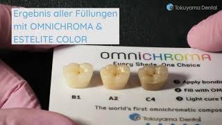 Anwendungsbeispiel OMNICHROMA von TOKUYAMA DENTAL [upl. by Hnao387]