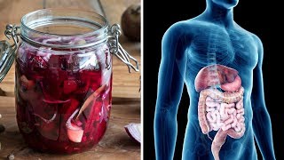 How To Make Beet Kvass  A Cleansing Medicinal Tonic [upl. by Dwyer953]