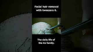 Facial hair removal with tweezers 6 facial hair removal shorts Plucking hair 毛抜き [upl. by Renrew]