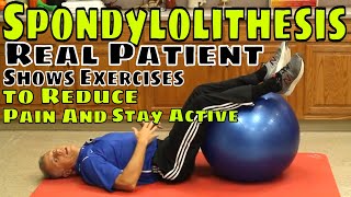 Spondylolithesis Real Patient Shows Exercises to Reduce Pain amp Stay Active [upl. by Badger237]