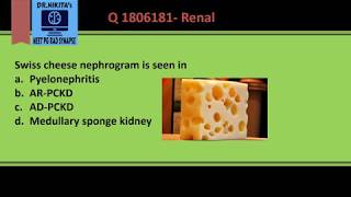 IVP in Polycystic kidney disease  Nephrogram appearance [upl. by Oiled]