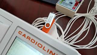 ECG EasyApp cardioline 100l [upl. by Ydnac]