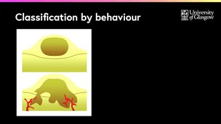 What are the differences between benign amp malignant tumours [upl. by Yessej]