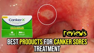 🌟 Banish Canker Sores FAST Top 3 Treatments Reviewed amp How to Use Them 🔥 [upl. by Tonkin686]