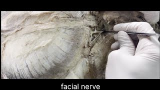 Facial nerve anatomy [upl. by Eniarrol]