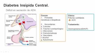 Diabetes Insípida [upl. by Neelcaj]