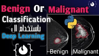 Benign Or Malignant  Classification projects using Deep learning تصنيف الخلايا الحميده والسرطانيه [upl. by Stegman]