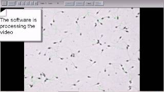 MMC Sperm sperm motility analysis in bright field [upl. by Gnod]