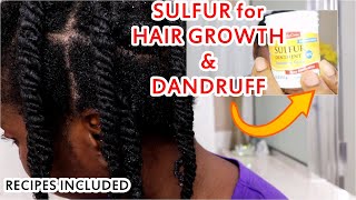 Sulfur for Hair Growth and Dandruff  RECIPES INCLUDED  DiscoveringNatural [upl. by Zebada]