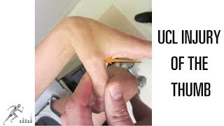 UCL injury of the thumb Mechanism of injury and treatment options [upl. by Ycak]