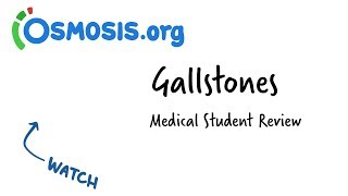 Gallstones  Clinical Presentation [upl. by Mike]