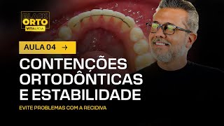 Aula 49  Contenções ortodônticas e estabilidade [upl. by Costin]