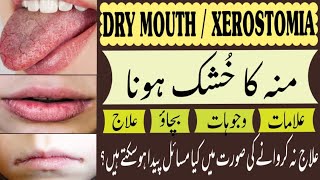 Dry Mouth منہ خُشک ہوناXerostomia  causes symptoms Prevention amp Treatment Home remediesdental [upl. by Eugen347]