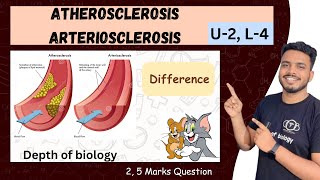 Atherosclerosis  atherosclerosis biochemistry  atherosclerosis pathology  arteriosclerosis [upl. by Hardi453]