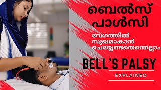 Bells Palsy Causes amp Treatmentബെൽസ് പാൾസി എങ്ങനെ വേഗത്തിൽ സുഖം പ്രാപിക്കാം bellspalsy arunvi [upl. by Feenah86]