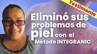 Cómo eliminar alergias y problemas de piel de forma natural y con medicina integrativa [upl. by Galan]