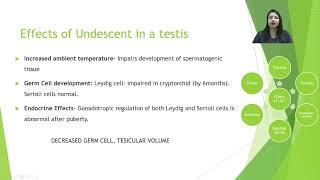 Lecture 3 Undescended testis Cryptorchidism by Dr Kanika Sharmam Pediatric Surgery IMS BHU [upl. by Calica]