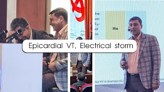 Epicardial Vt Electrical Storm [upl. by Aimahs]