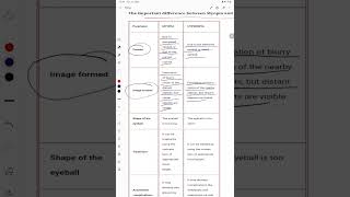 The important difference between Myopia and Hyperopia [upl. by Rehttam]