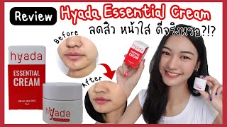 Review Hyada Essential Cream ครีมไฮยาดา ลดสิว หน้าใส ดีจริงหรอ คนขอเข้ามาเยอะมาก [upl. by Acisse]