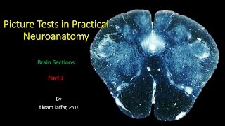 The DCML Pathway EXPLAINED  Dorsal ColumnsMedial Lemniscus [upl. by Yhtur]