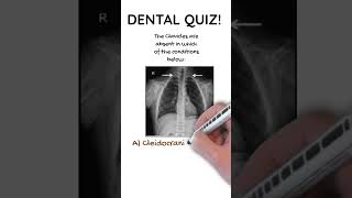 Dental Quiz 16 Syndromes [upl. by Junno]