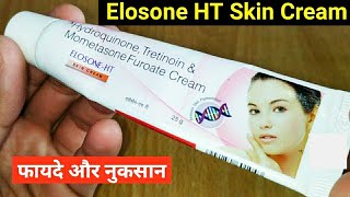 Elosone HT Skin Cream Ke Fayde Or Nuksan  Hydroquinone Tretinoin amp Mometasone Furoate Cream [upl. by Milt]